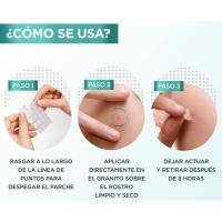 Parches para granitos GARNIER PURE ACTIVE, caja 22 uds